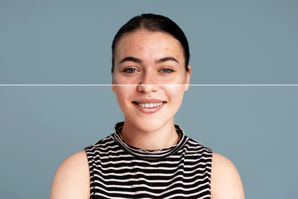 Can You Use Retinol Without Sunscreen? Here’s What You Need to Know