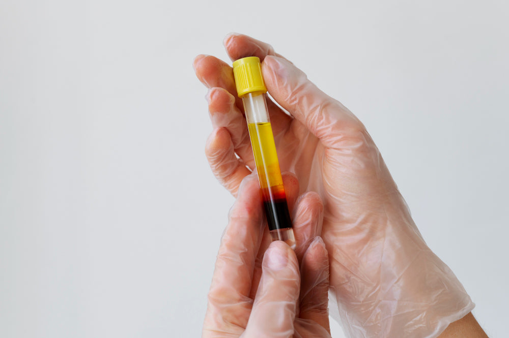 Calcium Blood Test: Normal Range, High, Low