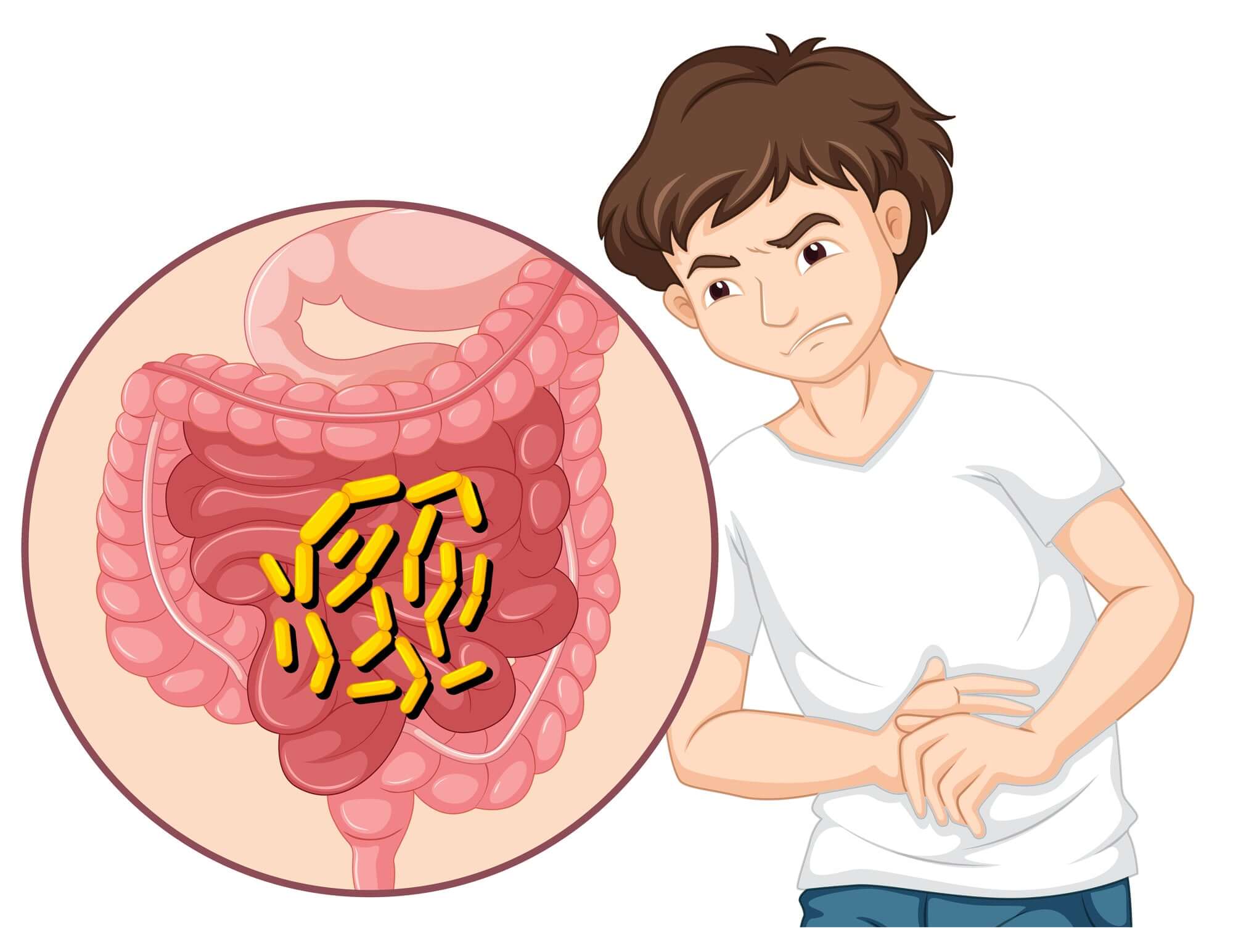 Understanding SIBO: Small Intestinal Bacterial Overgrowth Explained