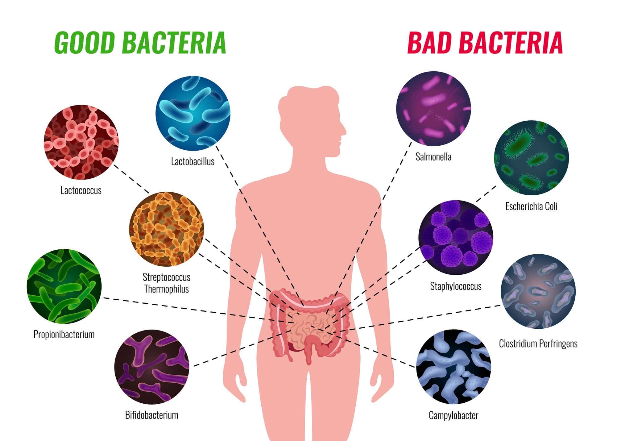 Can Probiotics Help with Leaky Gut and Eczema?