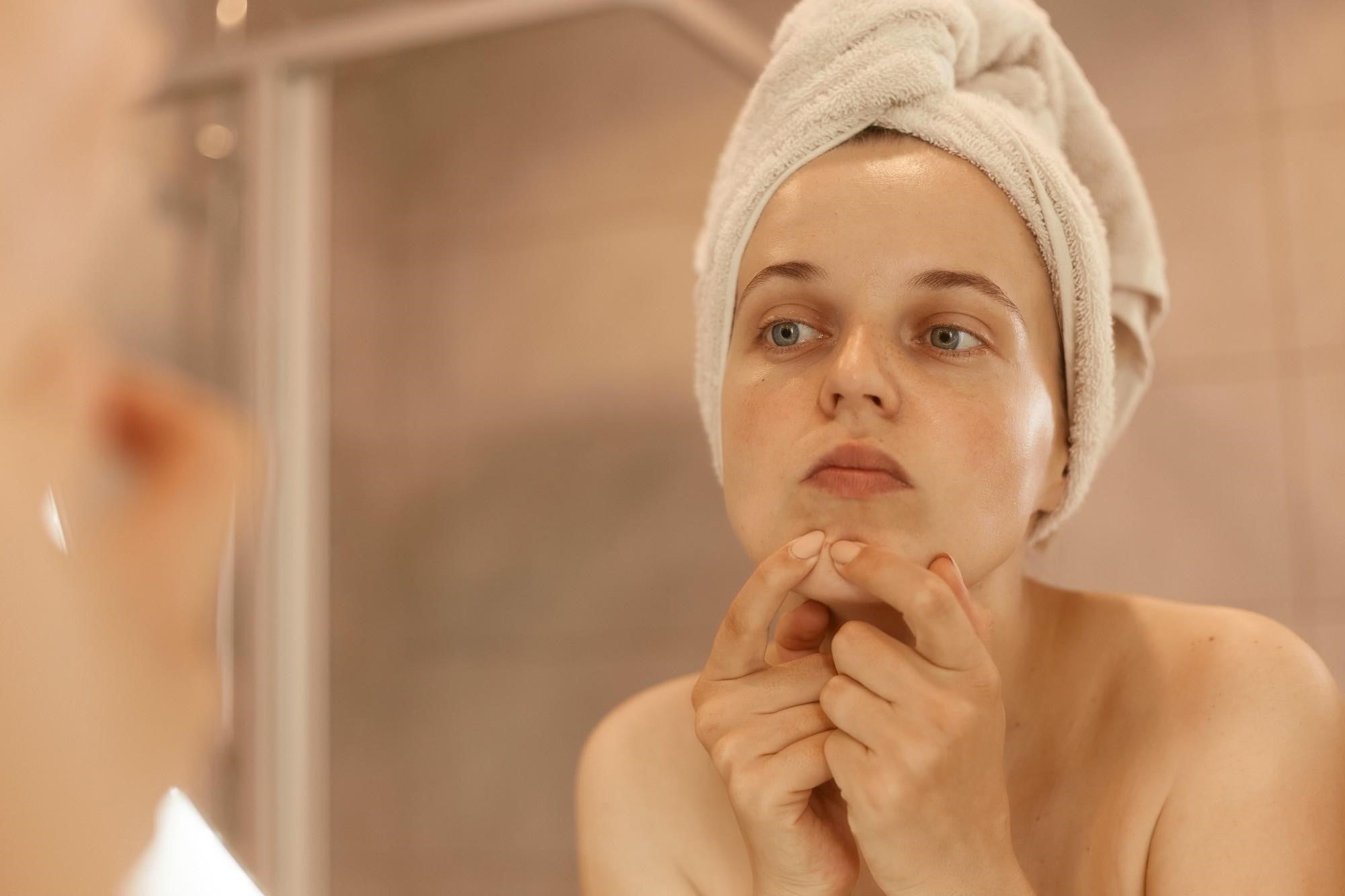 The Truth About Salicylic Acid vs. Benzoyl Peroxide: Harm or Benefit for Acne?