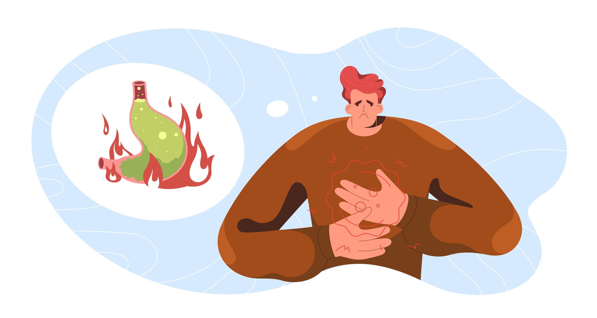 How Acid Reflux Medications Might Be Stealing Your Calcium