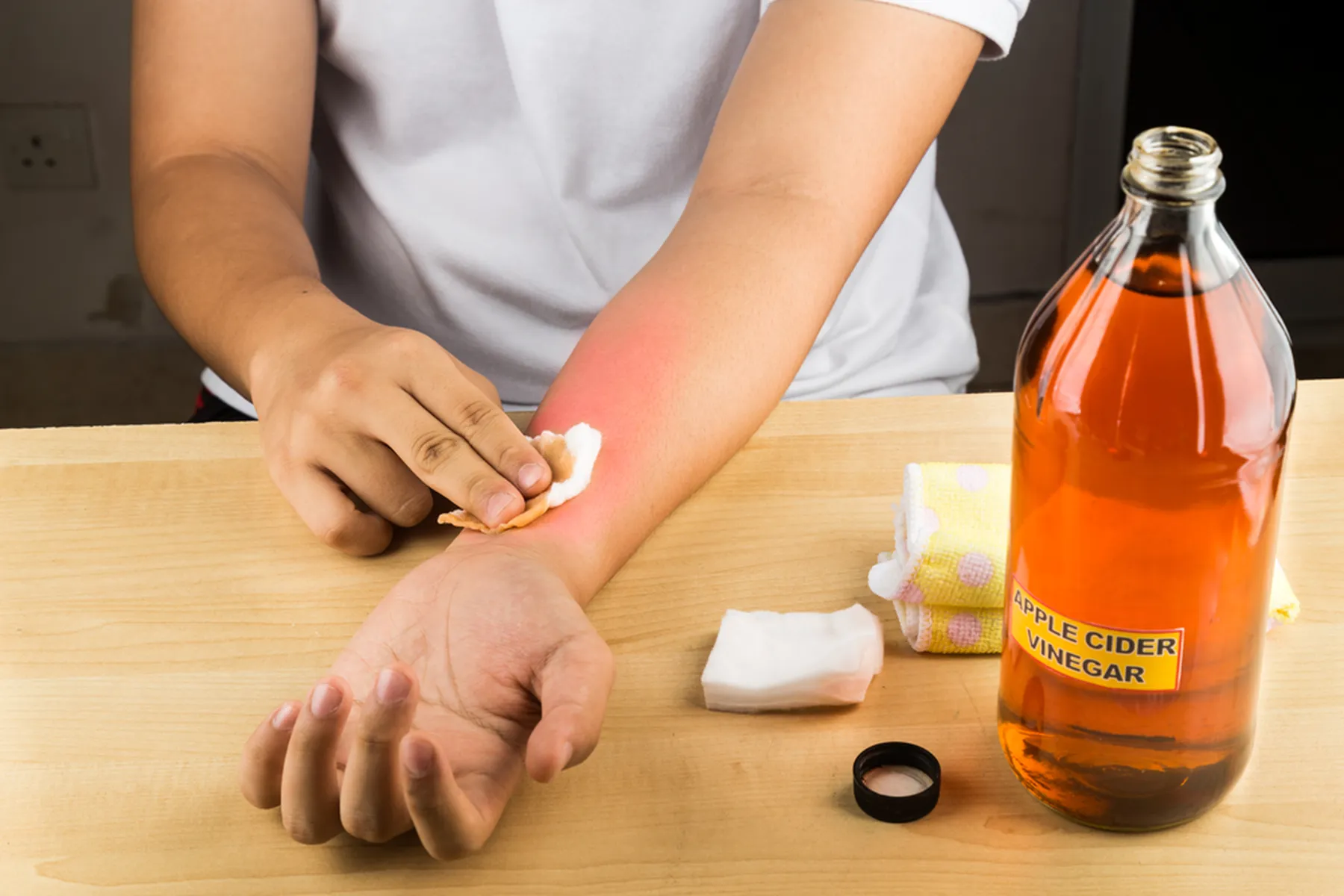 3 Important ACV Uses for Eczema and Itchy Rash Care – Nano Singapore MY
