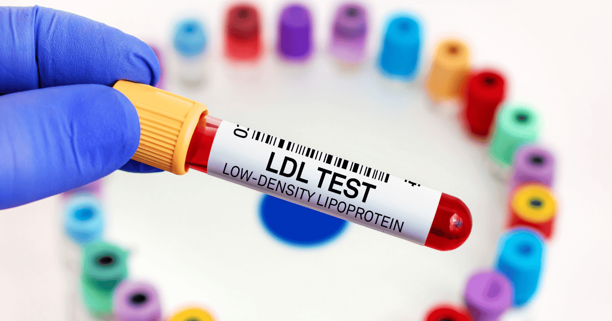 What Your Cholesterol Numbers Really Mean