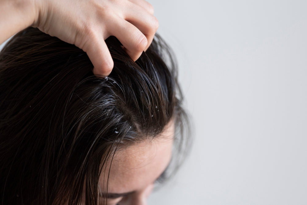 The Role of Bilberry in Scalp Circulation