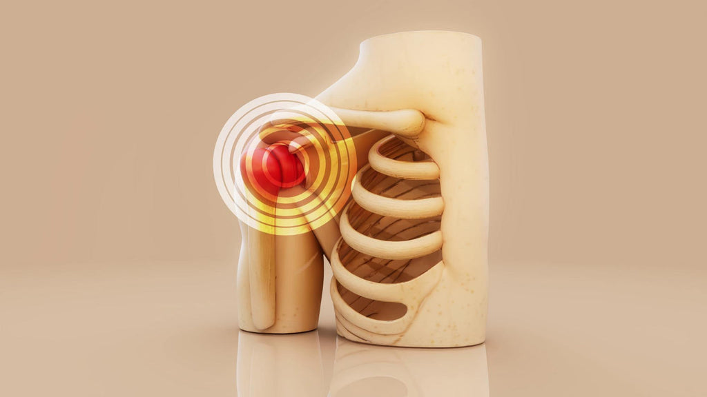 Osteoporosis Prevention for Women: Start in Your 30s