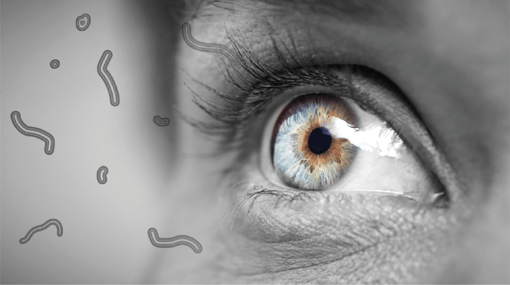 Seeing Spots? It Could Be Eye Floaters