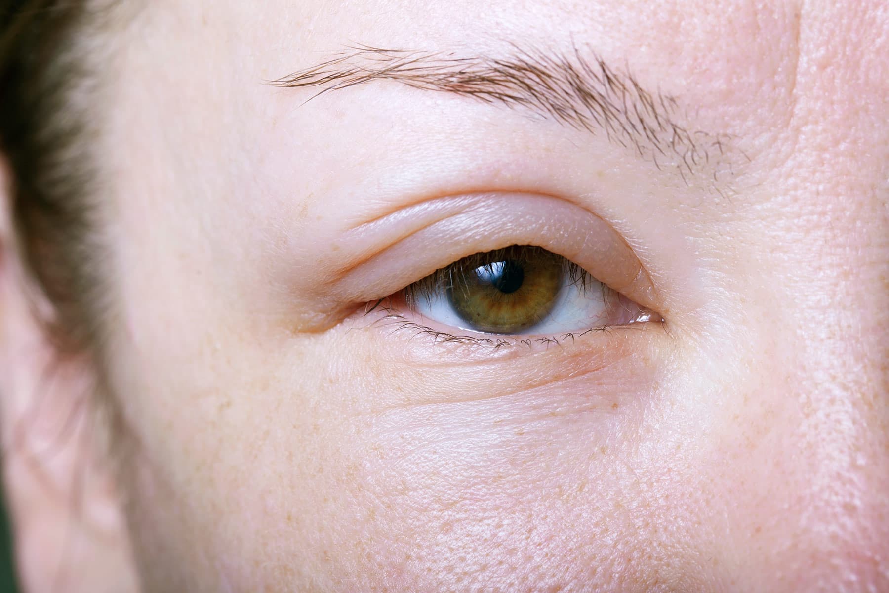 Support for a Less Puffy Morning Face
