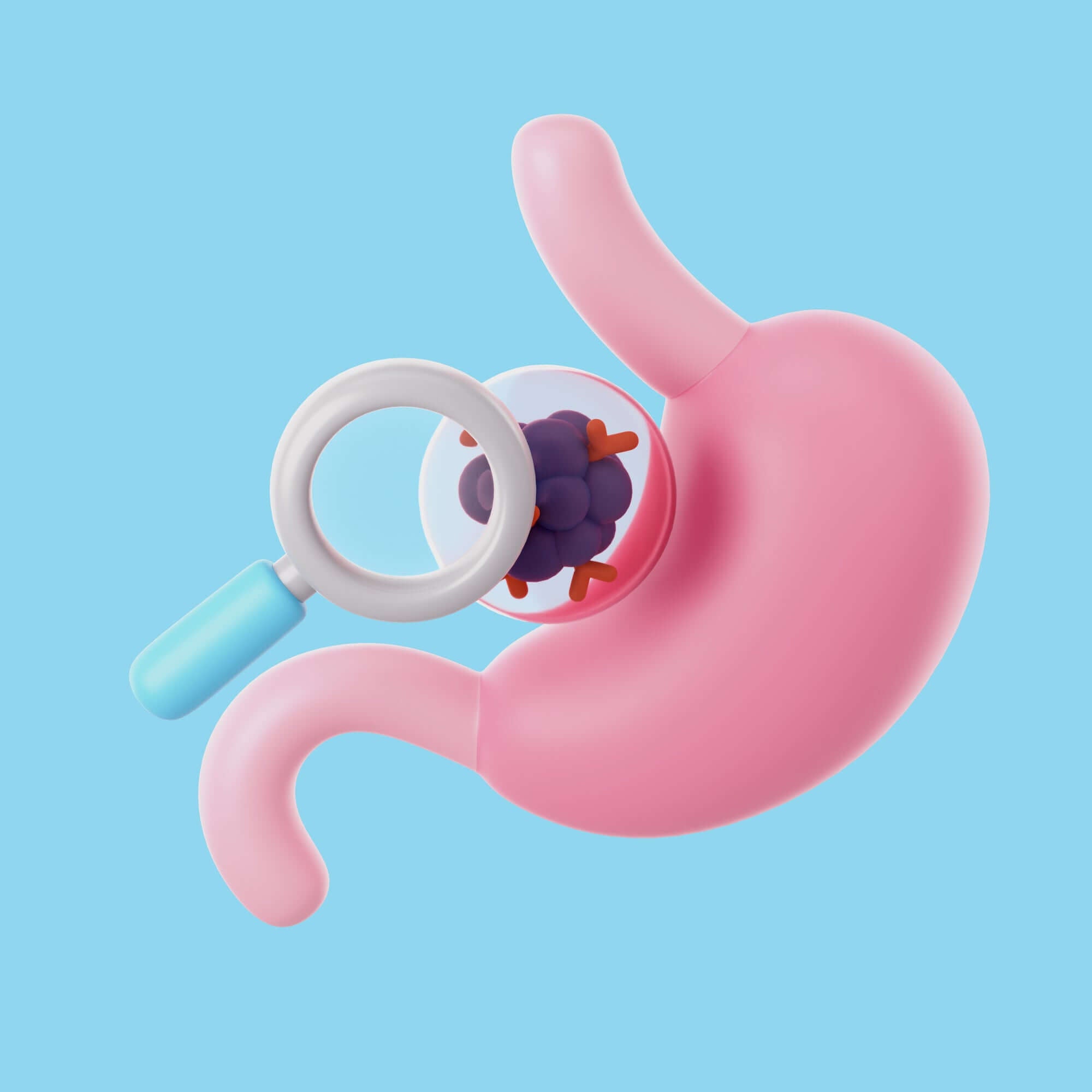 Harnessing the Power of Probiotics: A Potential Ally in Hiatus Hernia Care