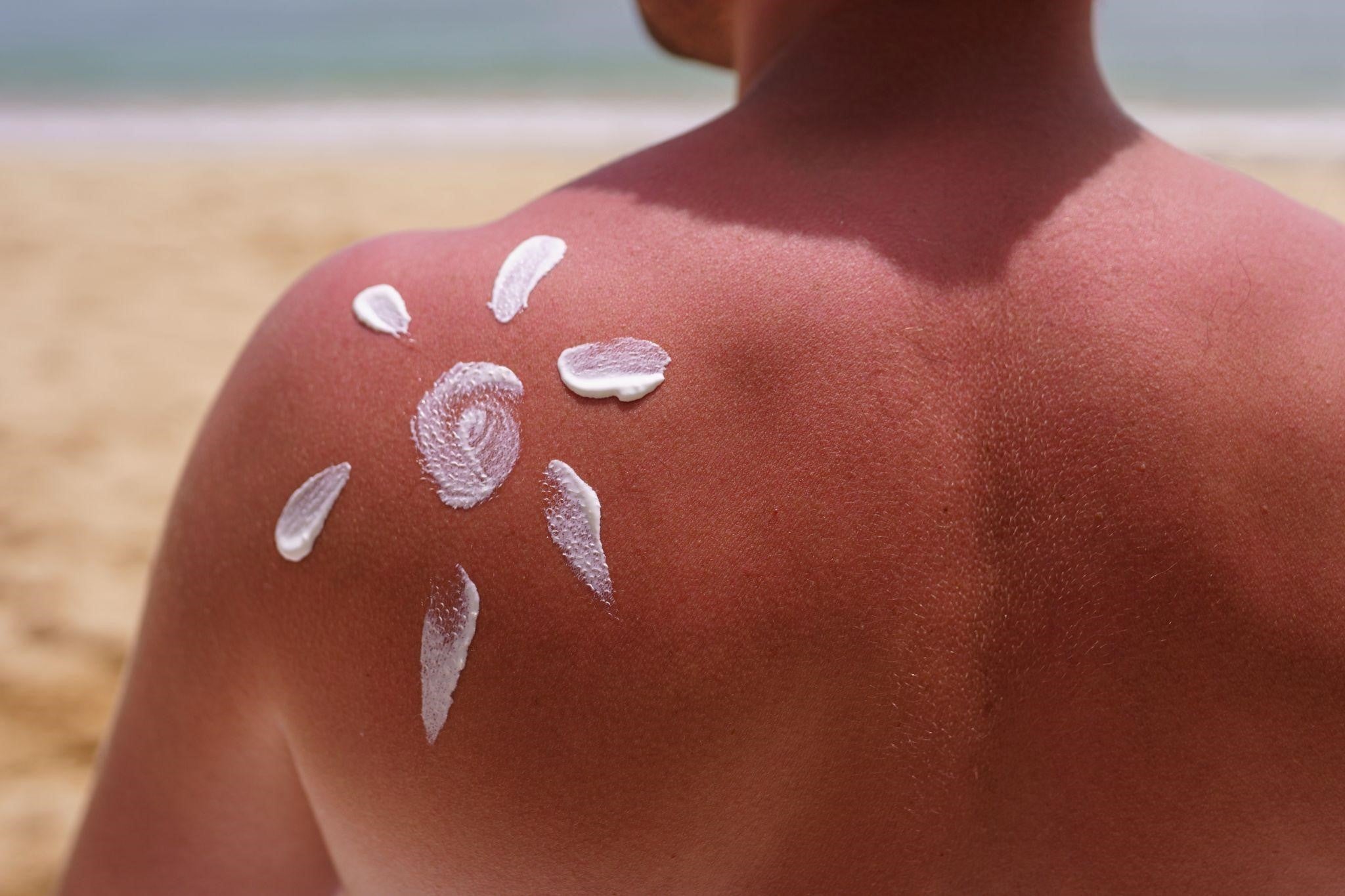 Do We Really Need Sunscreen Every Day?