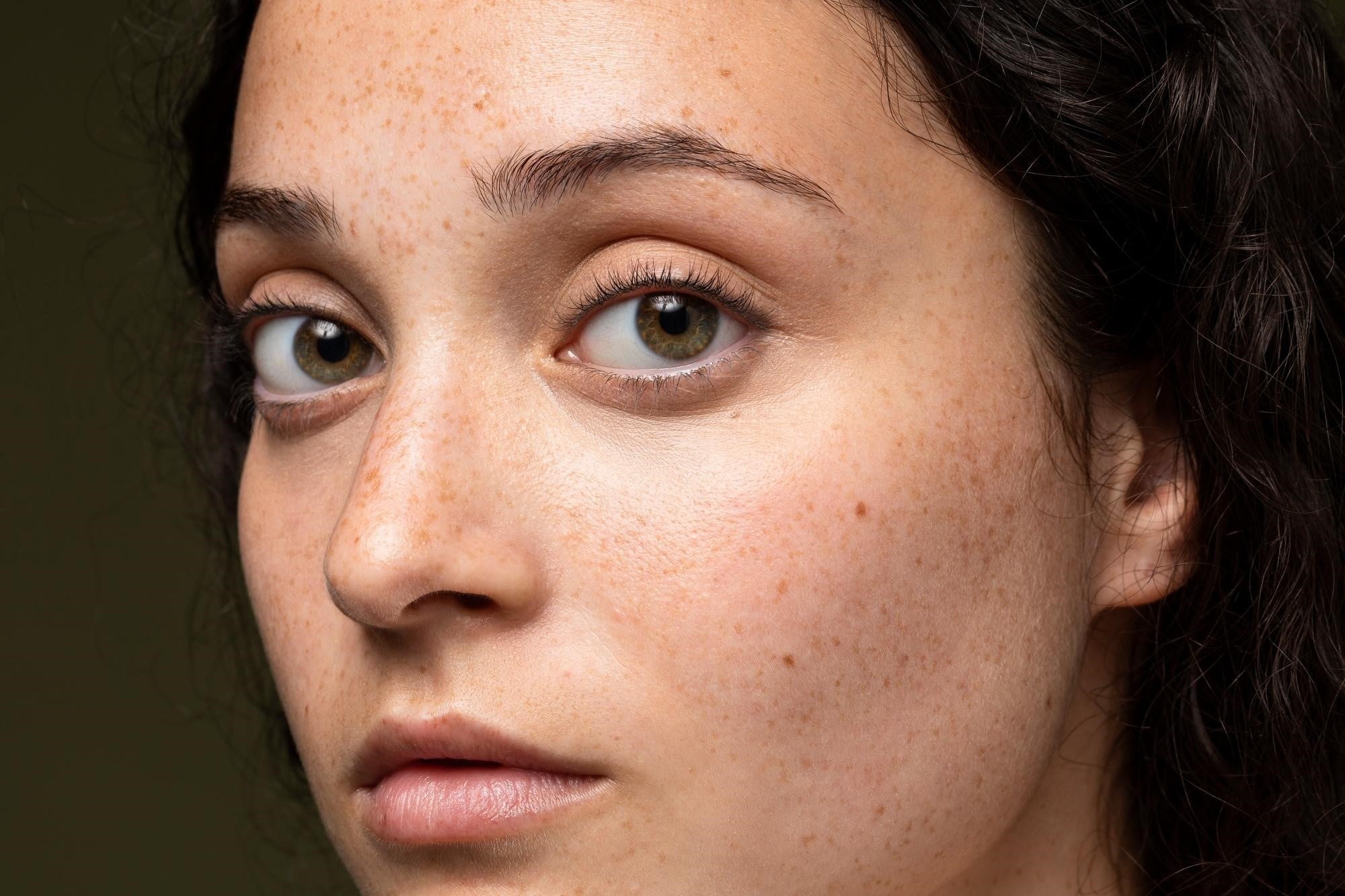 How Vitamin C Serum Transforms Skin Brightness and Reduces Dark Spots