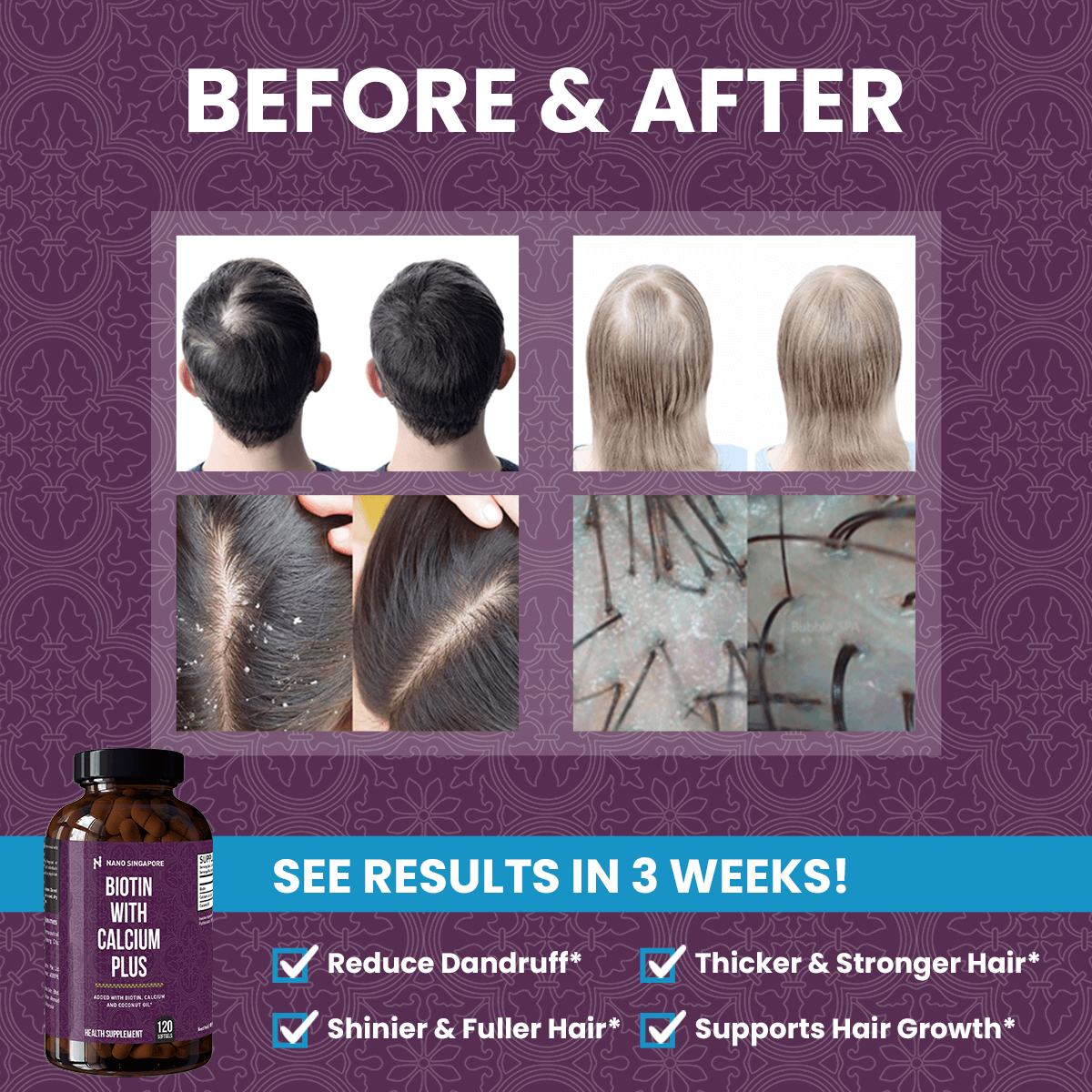 Biotin with Calcium 12,120mcg
