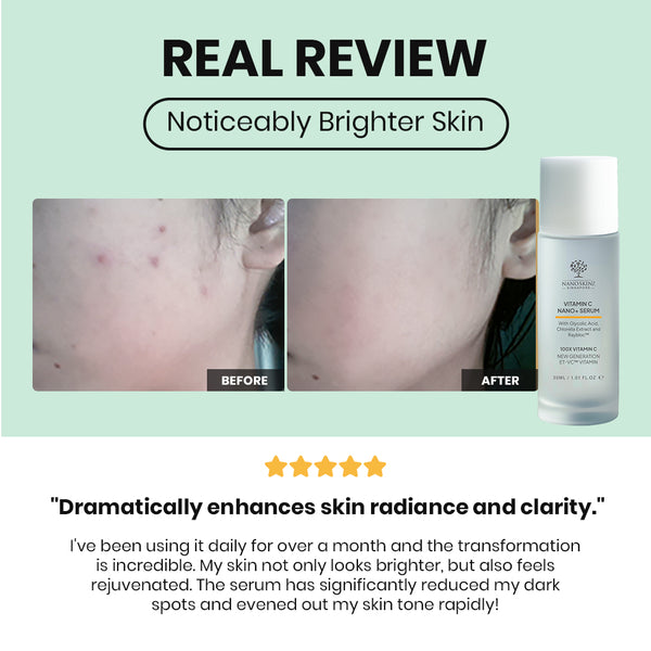 NANOSKINZ Vitamin C Serum - 30ml